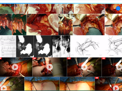Archivio Chirurgico Digitale video e fotografico - Maker Faire