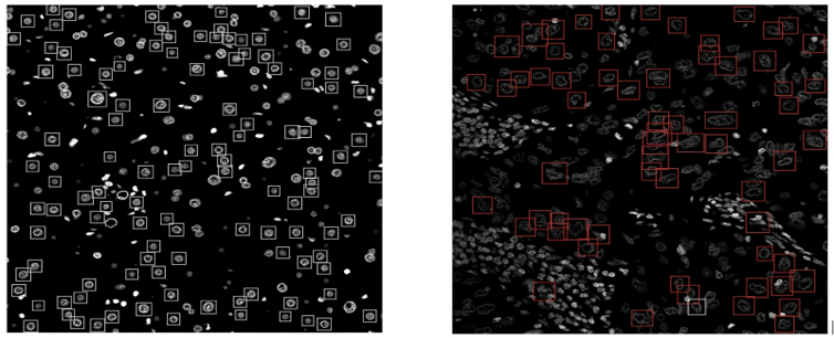 Intelligenza artificiale come supporto alla diagnosi di epatocarcinoma - Maker Faire