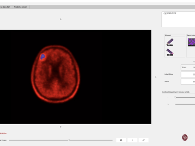 matRadiomics - Innovative Tool Radiomics Analysis - Maker Faire rome 2024